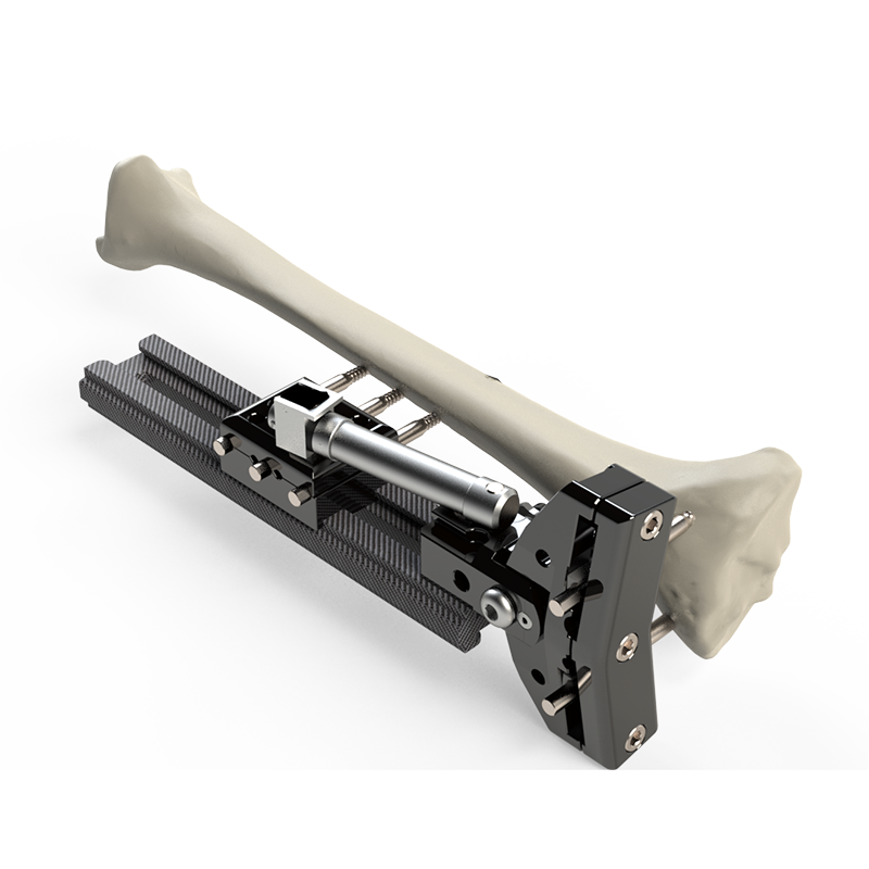 Fixador Externo Não Estéril - FEST II