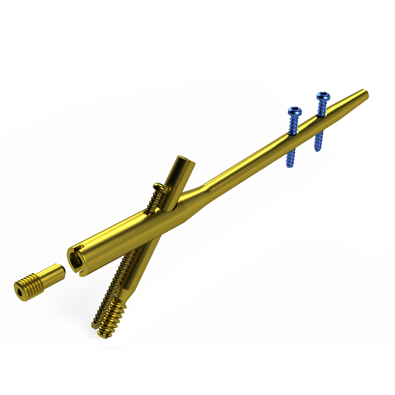 Haste Intramedular Bloqueada em Titânio