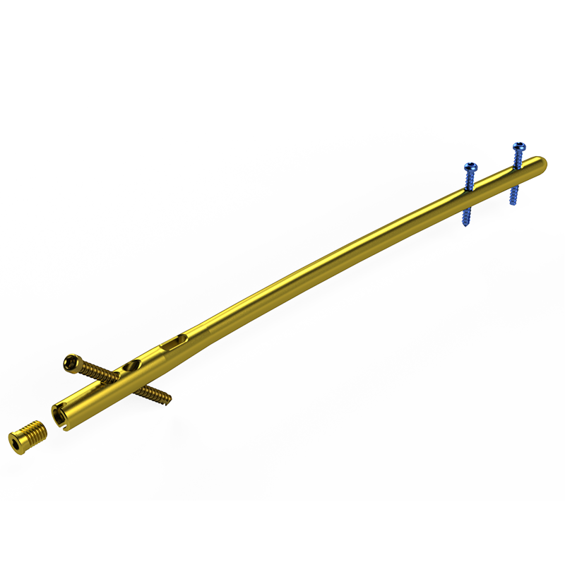 Haste Intramedular Bloqueada em Titânio