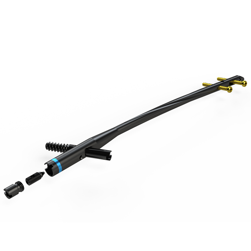 Haste Intramedular Bloqueada em Titânio